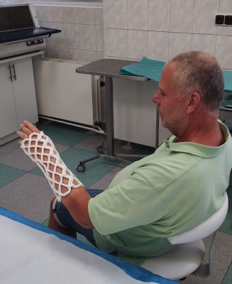 Zlomená ruka už dovolenou neohrozí: revoluční alternativa sádry je nyní dostupná v Nemocnici AGEL Říčany